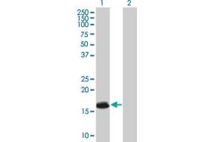 Western Blotting (WB) image for ATRX 293T Cell Transient Overexpression Lysate(Denatured) (ABIN1331024)