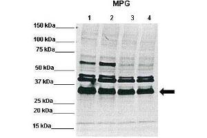 WB Suggested Anti-MPG Antibody    Positive Control:  Lane1: 50ug RCC4 lysate, Lane2: 50ug RCC4 lysate, Lane3: 50ug 786-0 lysate, Lane4: 50ug 786-0 lysate  Primary Antibody Dilution :   1:1000  Secondary Antibody :   Anti-rabbit-Alexa 680   Secondry Antibody Dilution :   1:5000  Submitted by:  Dr Ester Hammond, Gray Institute for Radiation Oncology and Biology-Department of Oncology, University of Oxford (MPG 抗体  (C-Term))