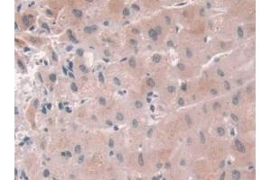 DAB staining on IHC-P; Samples: Human Liver Tissue (USP6NL 抗体  (AA 1-292))