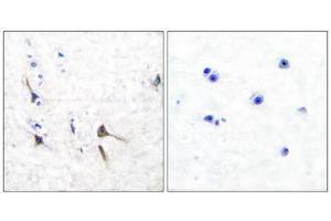 Immunohistochemistry (IHC) image for anti-Kv3.2b Potassium Channel (C-Term) antibody (ABIN1848746) (Kv3.2b Potassium Channel 抗体  (C-Term))