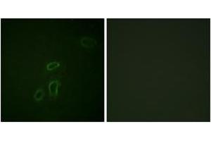 Immunofluorescence analysis of HepG2 cells, using CD171/N-CAML1 (Ab-1181) Antibody. (L1CAM 抗体  (AA 1147-1196))