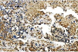 IHC analysis of HDAC4 using anti-HDAC4 antibody (ABIN5518841). (HDAC4 抗体  (AA 4-213))