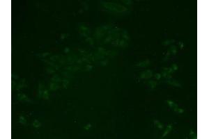 Immunohistochemistry (IHC) image for anti-Tight Junction Protein 2 (Zona Occludens 2) (TJP2) (AA 307-669) antibody (ABIN7441247)