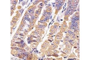 IHC analysis of FFPE mouse stomach section using Ror2 antibody; Ab was diluted at 1:25. (ROR2 抗体  (AA 750-800))