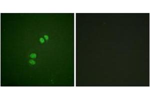 Immunofluorescence (IF) image for anti-Polo-Like Kinase 1 (PLK1) (AA 176-225) antibody (ABIN2888693) (PLK1 抗体  (AA 176-225))