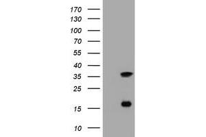 Image no. 5 for anti-Thymidylate Synthetase (TYMS) antibody (ABIN1501589) (TYMS 抗体)