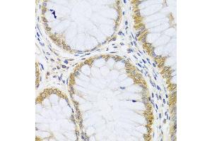 Immunohistochemistry of paraffin-embedded human colon using ARL6 antibody at dilution of 1:100 (x40 lens). (ARL6 抗体)