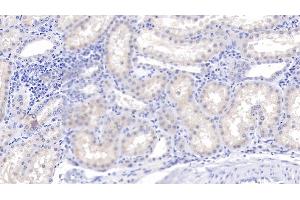 Detection of C1qB in Human Kidney Tissue using Polyclonal Antibody to Complement Component 1, Q Subcomponent B (C1qB) (C1QB 抗体  (AA 28-253))