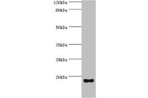 Western blot All lanes: Urotensin-2 antibody at 8 μg/mL + Rat brain tissue Secondary Goat polyclonal to rabbit IgG at 1/10000 dilution Predicted band size: 15, 17 kDa Observed band size: 15 kDa (Urotensin 2 抗体  (AA 35-124))