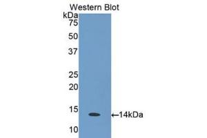 Western blot analysis of the recombinant protein. (CCL26 抗体  (AA 24-94))