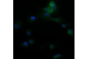Image no. 2 for anti-Amyloid P Component, Serum (APCS) antibody (ABIN1500900) (APCS 抗体)
