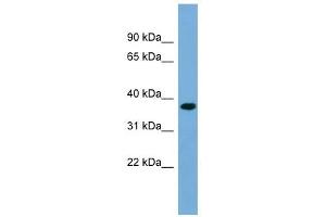 RPRD1B antibody used at 1 ug/ml to detect target protein.