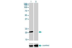 Western blot analysis of ATF3 over-expressed 293 cell line, cotransfected with ATF3 Validated Chimera RNAi (Lane 2) or non-transfected control (Lane 1). (ATF3 抗体  (AA 1-181))