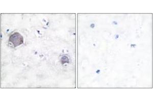 Immunohistochemistry (IHC) image for anti-Notch 1 (NOTCH1) (AA 1735-1784), (Cleaved-Val1744) antibody (ABIN2891164) (Notch1 抗体  (Cleaved-Val1744))