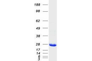 Validation with Western Blot