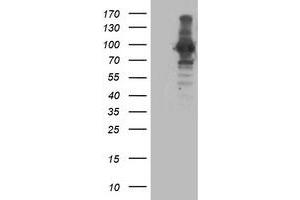 Western Blotting (WB) image for anti-Anaphase Promoting Complex Subunit 2 (ANAPC2) antibody (ABIN1496636) (ANAPC2 抗体)