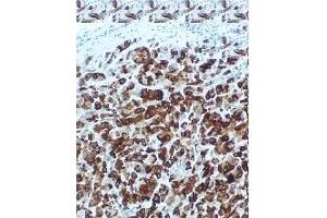 Immunohistochemistry (IHC) image for anti-Secretoglobin, Family 2A, Member 2 (SCGB2A2) antibody (ABIN452654) (Mammaglobin A 抗体)