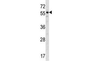 BMP3 antibody western blot analysis in ZR-75-1 lysate. (BMP3 抗体  (AA 318-347))