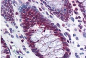 Human Colon: Formalin-Fixed, Paraffin-Embedded (FFPE) (RPL39L 抗体  (AA 1-52))