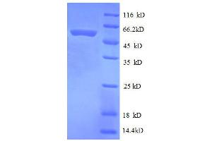 30S Ribosomal Protein S2 (AA 2-241), (full length) protein (GST tag) (30S Ribosomal Protein S2 Protein (AA 2-241, full length) (GST tag))