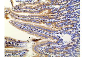 Immunohistochemistry (IHC) image for anti-Phosphoinositide 3 Kinase, p85 alpha (PI3K p85a) (pTyr607) antibody (ABIN6256775)