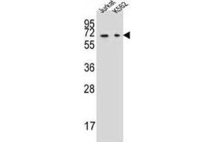 Western Blotting (WB) image for anti-Dihydropyrimidinase (DPYS) antibody (ABIN2997327) (DPYS 抗体)