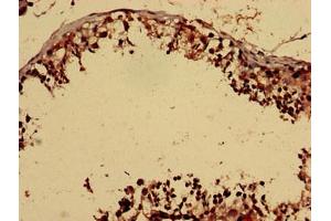 Immunohistochemistry analysis of human testis tissue using ABIN7153092 at dilution of 1:100 (FOXP1 抗体  (AA 541-677))