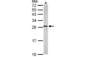 WB Image Sample (50 ug of whole cell lysate) A: mouse brain 12% SDS PAGE antibody diluted at 1:500 (rala 抗体  (Center))