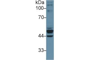 Western Blot; Sample: Human Placenta lysate; Primary Ab: 1µg/ml Rabbit Anti-Human KRT23 Antibody Second Ab: 0. (KRT23 抗体  (AA 243-382))