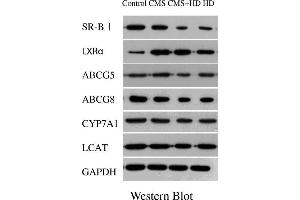 The results of qPCR showed that high fat diet (HD) significantly decreased the expression of LXRα, ABCG5, ABCG8, SR-BI, CYP7A1 and LCAT,and CMS alone significantly elevated the expression of LXRα, ABCG5, ABCG8, and SR-BI, while CMS + HD significantly decreased the expression of ABCG5, ABCG8, CYP7A1 and LCAT. (CYP7A1 抗体  (AA 351-400))