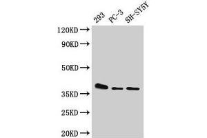 Western Blot Positive WB detected in: 293 whole cell lysate, PC-3 whole cell lysate, SH-SY5Y whole cell lysate All lanes: ELOVL4 antibody at 1:500 Secondary Goat polyclonal to rabbit IgG at 1/50000 dilution Predicted band size: 37 kDa Observed band size: 37 kDa (ELOVL4 抗体  (AA 270-314))