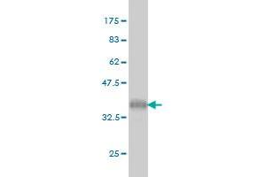 Western Blot detection against Immunogen (36. (UHRF1 抗体  (AA 694-793))