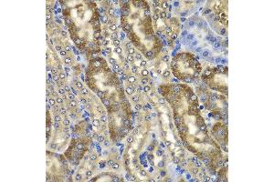 Immunohistochemistry of paraffin-embedded mouse kidney using NMT2 antibody at dilution of 1:100 (x400 lens). (NMT2 抗体)