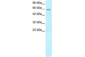 FOXG1A antibody used at 5-8 ug/ml to detect target protein. (FOXG1 抗体  (N-Term))