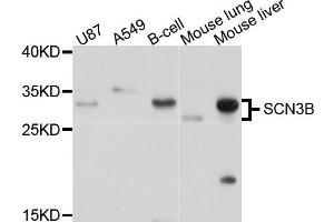 Western blot analysis of extract of various cells, using SCN3B antibody. (SCN3B 抗体)