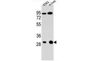 Western blot analysis of ETFA Antibody (C-term) Cat. (ETFA 抗体  (C-Term))