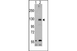 Image no. 1 for anti-Transient Receptor Potential Cation Channel, Subfamily M, Member 8 (TRPM8) (Middle Region) antibody (ABIN360716) (TRPM8 抗体  (Middle Region))