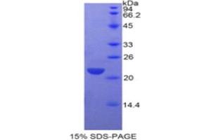 SDS-PAGE analysis of Human CLEC3B Protein. (CLEC3B 蛋白)