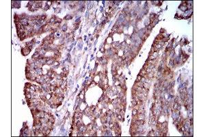 Immunohistochemistry (IHC) image for anti-Signal Transducer and Activator of Transcription 5A (STAT5A) (AA 583-794) antibody (ABIN1845625) (STAT5A 抗体  (AA 583-794))