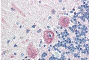 Human Brain, Cerebellum (formalin-fixed, paraffin-embedded) stained with KIAA0152 antibody ABIN351427 at 5 ug/ml followed by biotinylated goat anti-rabbit IgG secondary antibody ABIN481713, alkaline phosphatase-streptavidin and chromogen. (Malectin 抗体  (N-Term))