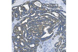 IHC analysis of EEF2/Elongation factor 2 using anti-EEF2/Elongation factor 2 antibody (ABIN7603142).