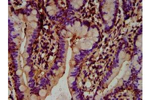 IHC image of ABIN7164423 diluted at 1:300 and staining in paraffin-embedded human small intestine tissue performed on a Leica BondTM system. (HECTD2 抗体  (AA 674-776))
