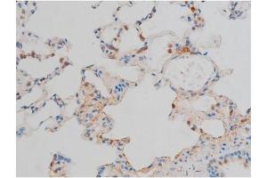 Immunohistochemistry (IHC) image for anti-cAMP Responsive Element Binding Protein 1 (CREB1) (pSer142) antibody (ABIN6254981)