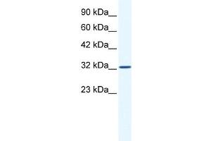 WB Suggested Anti-SNAPC2 Antibody Titration:  1. (SNAPC2 抗体  (Middle Region))