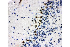 Anti-B MyB antibody, IHC(P) IHC(P): Rat Brain Tissue (MYBL2 抗体  (N-Term))
