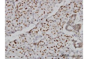 Immunoperoxidase of monoclonal antibody to CMAS on formalin-fixed paraffin-embedded human salivary gland. (CMAS 抗体  (AA 164-263))