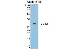 Western Blotting (WB) image for anti-Janus Kinase 2 (JAK2) (AA 564-809) antibody (ABIN3203631) (JAK2 抗体  (AA 564-809))