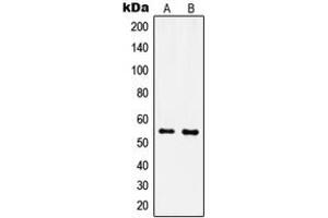 Western blot analysis of IPPK expression in MCF7 (A), NIH3T3 (B) whole cell lysates.