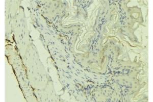 ABIN6273220 at 1/100 staining Mouse colon tissue by IHC-P. (CX3CL1 抗体  (Internal Region))