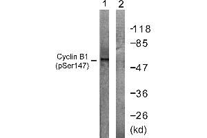Immunohistochemistry analysis of paraffin-embedded human placenta tissue using Cyclin B1 (Phospho-Ser147) antibody. (Cyclin B1 抗体  (pSer147))